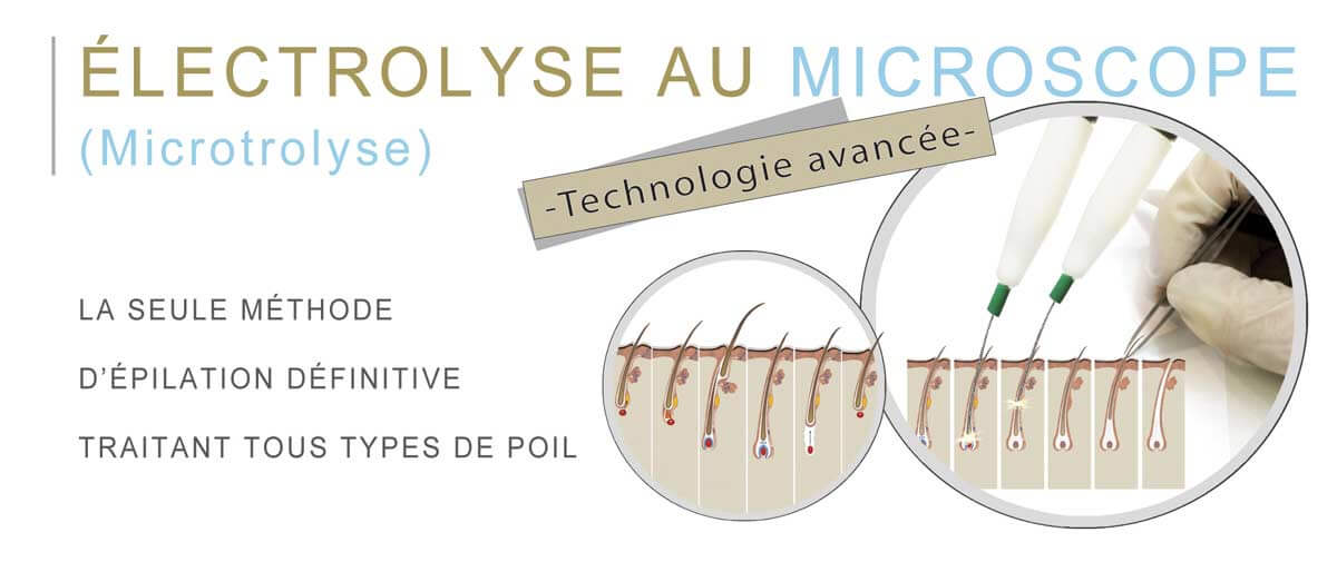 explicationelectrolyse centrejowelle solliespont centre jowelle sollies pont centre de beauté